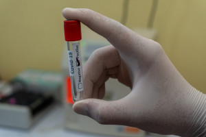 Reino Unido estudia eliminar las PCR de los viajes para los vacunados