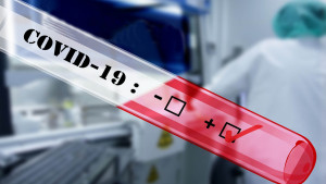Uruguay cambiará requisito de PCR por antígeno y “podría ir más allá”